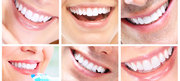 Dentist Baulkham Hills