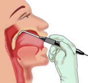 Treatment for Sleep Apnoea