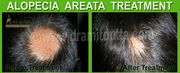 Ayurvedic Hair Treatments : Ayurvedic Hair Specialist  Dr. Amit Dutta