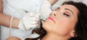 Microdermabrasion Treatment Sydney- An Overview