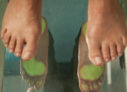 Expert Orthotic Solutions Podiatry for Foot Disorders