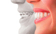 Adam Dental Care –Get the Beautiful Smile You Deserve