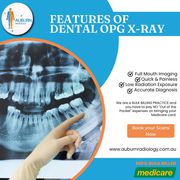 Features of Dental OPG X-Ray at Auburn Radiology.(02) 8315 8292 