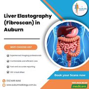 Liver Elastography (Fibroscan) at Auburn Radiology. (02) 8315 8292