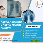 Fast & Accurate Chest X-Rays at Auburn Radiology. (02) 8315 8292