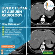 Liver CT Scan at Auburn Radiology. (02) 8315 8292